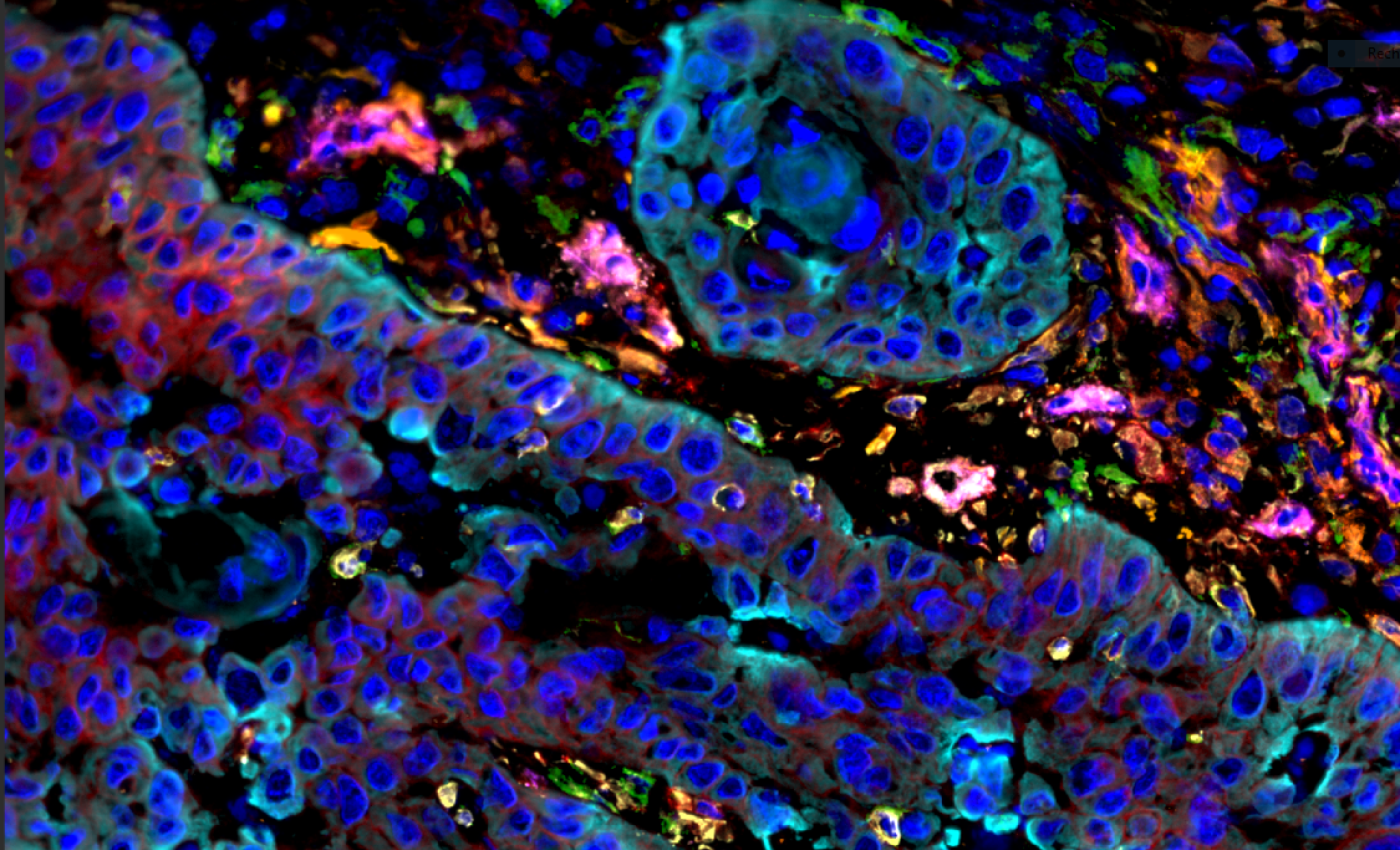 vielversprechende Ergebnisse durch die PerVision-Studie